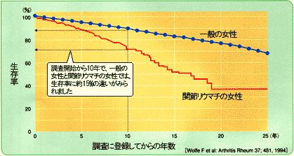 関節リウマチの予後