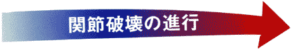 進行矢印