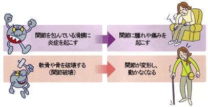 TNFαの悪さ