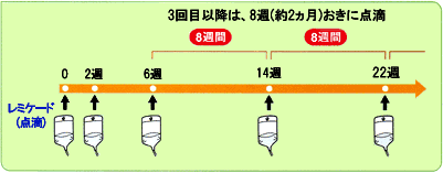 レミケード投与スケジュール