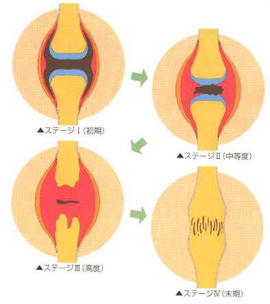 原因
